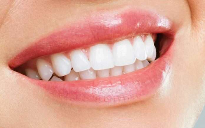 How to remove yellow stains on teeth