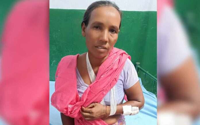 Female tea worker injured in leopard attack