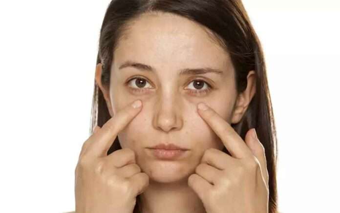 Want to eliminate the problem of dark circles follow some rules